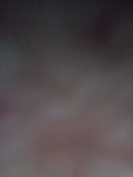 Spider bite online show from February 23, 2026, 8:53 pm